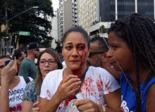 Professora agredida por PM fala da luta contra a reforma da Previdência de Covas